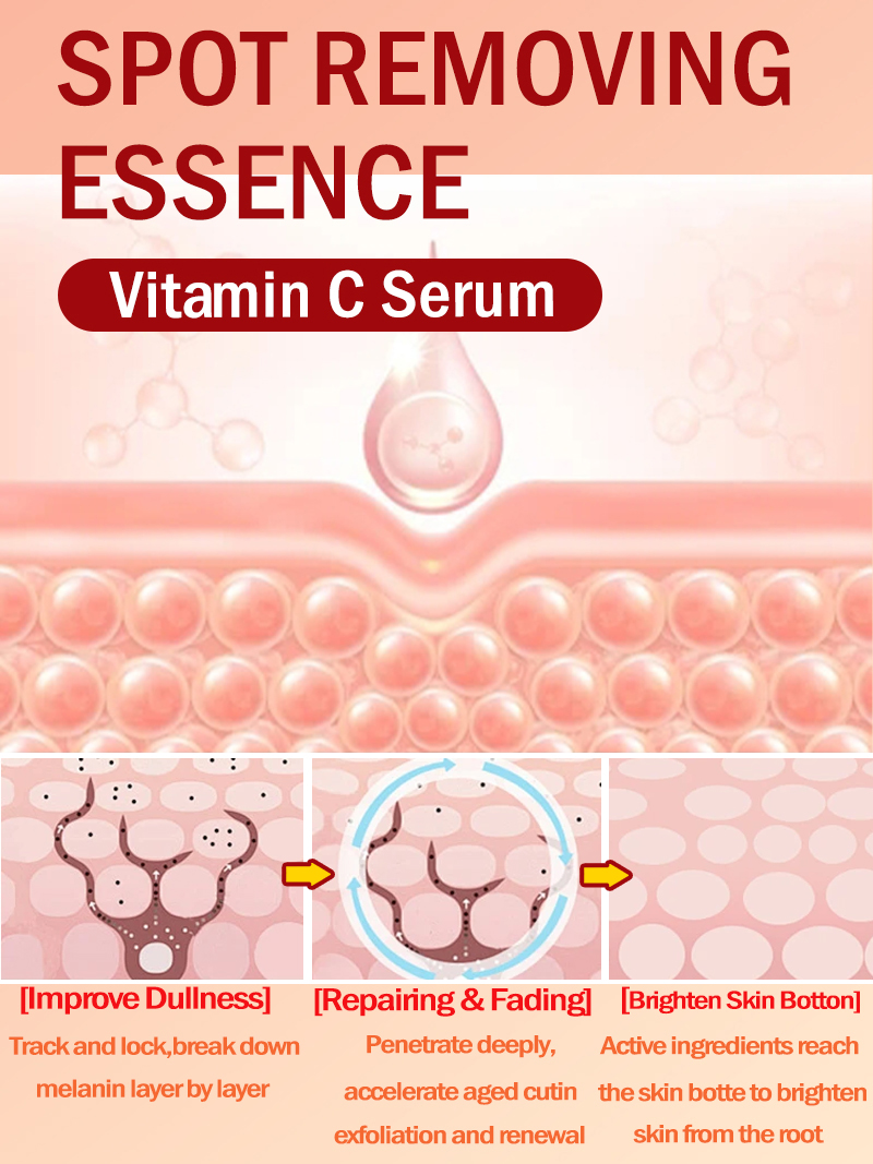 Lighten Freckles Melasma, Faci - огляд і ціна Ultra Luxury Skincare